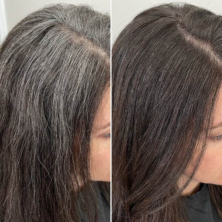 Before and After