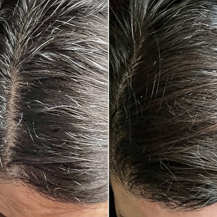 Before and After