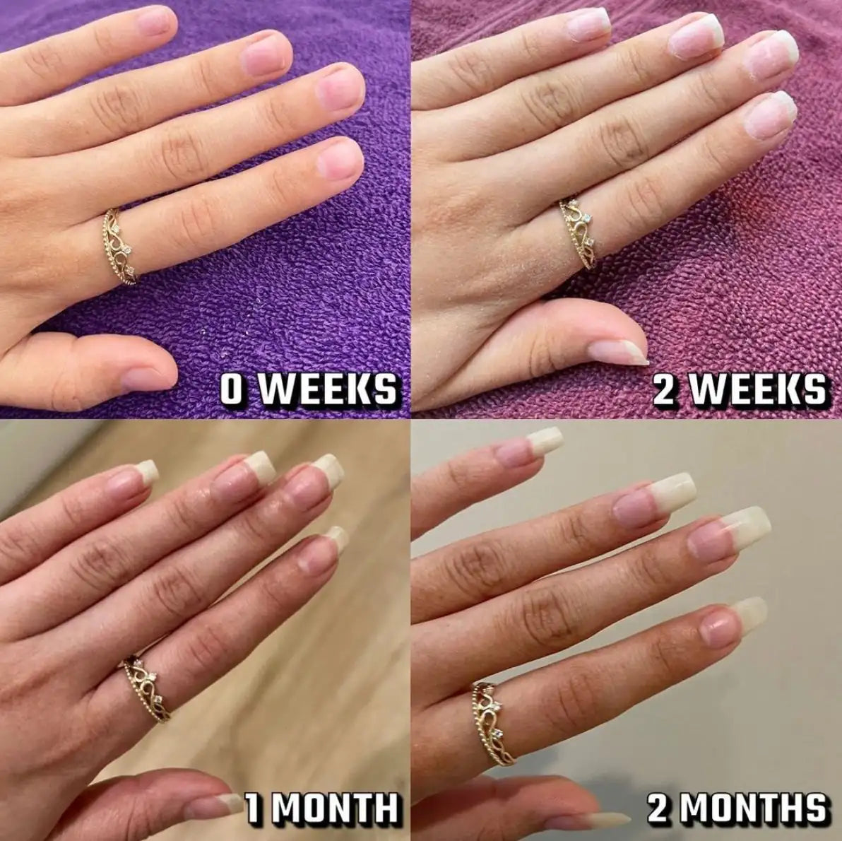 Nail growth progress at 0 weeks, 2 weeks, 1 month and 2 months