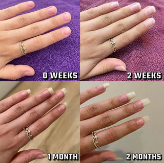 Nail growth progress at 0 weeks, 2 weeks, 1 month and 2 months