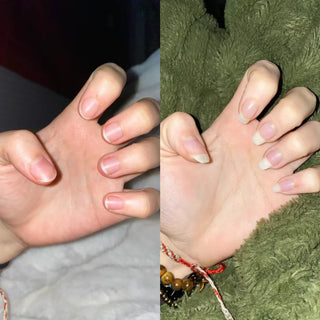 Before and after over several months