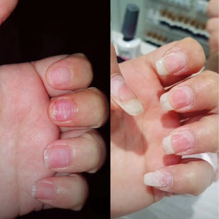 Before and after on damaged nails