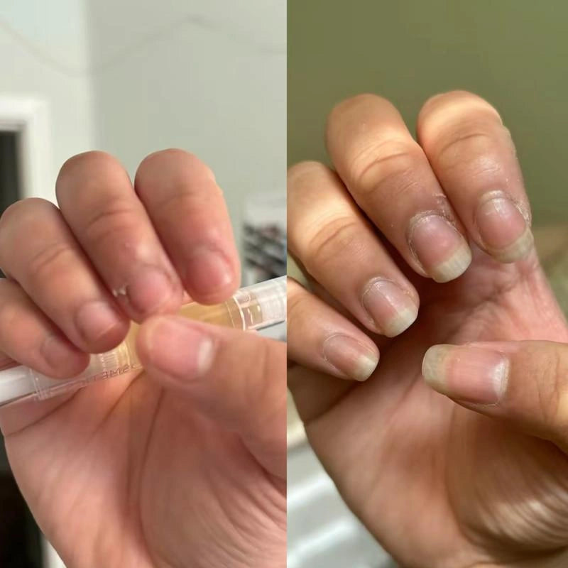 The brush applicator being used on the cuticle