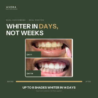 Whiter in days, not weeks - day 1 versus day 14