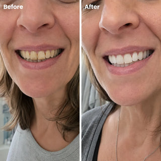 Zero Pro Toothpaste with BioFuse Oil Matrix