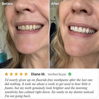 Zero Pro Toothpaste with BioFuse Oil Matrix