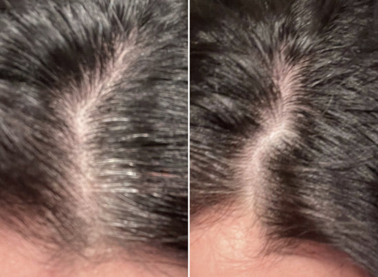 Before and After