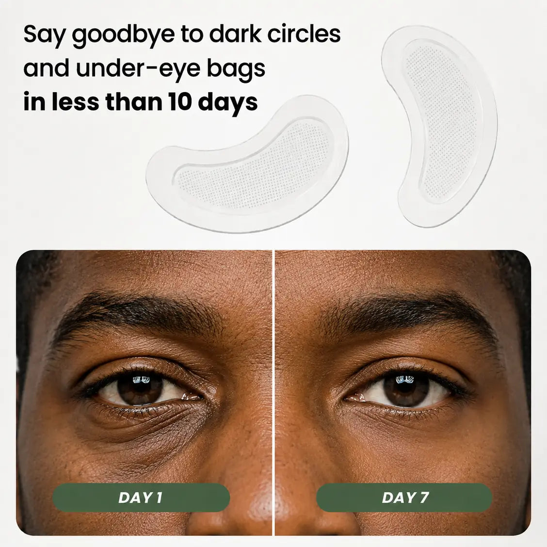 Microneedle Patches - New Generation
