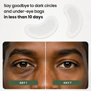 Microneedle Patches - New Generation