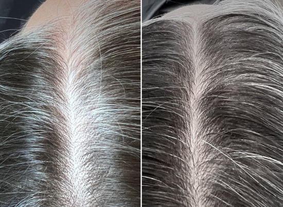 Before and After