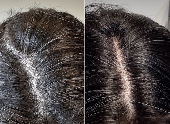 Before and After