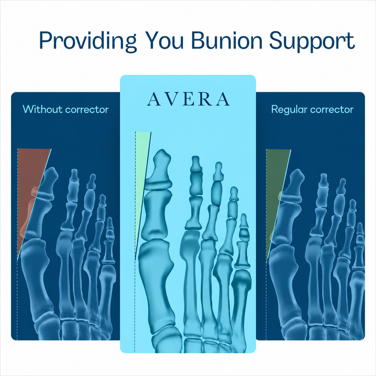 Toe position with and without support