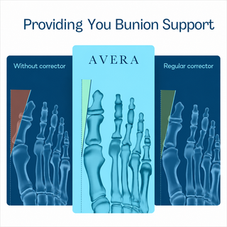 Toe position with and without support