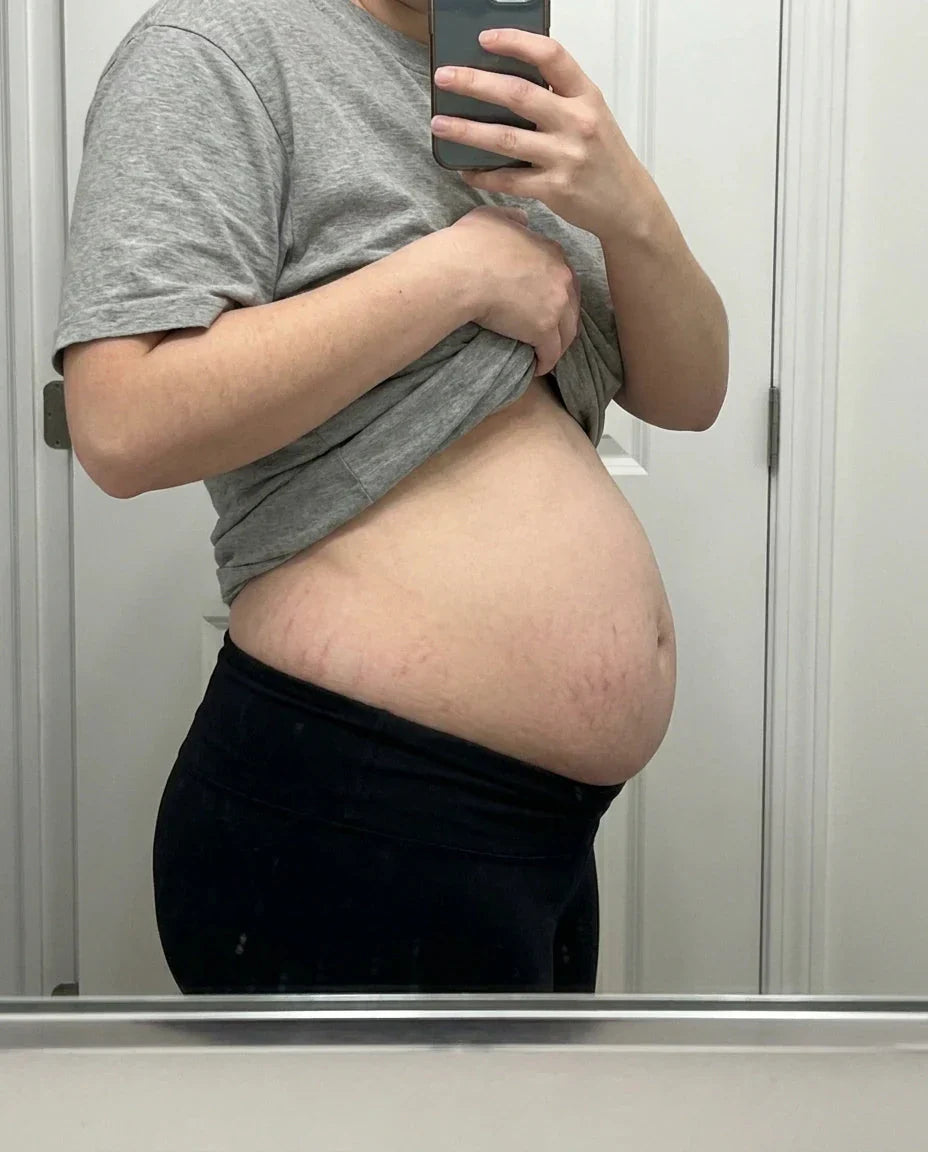 Side profile of a belly a few weeks after birth, mirror photo