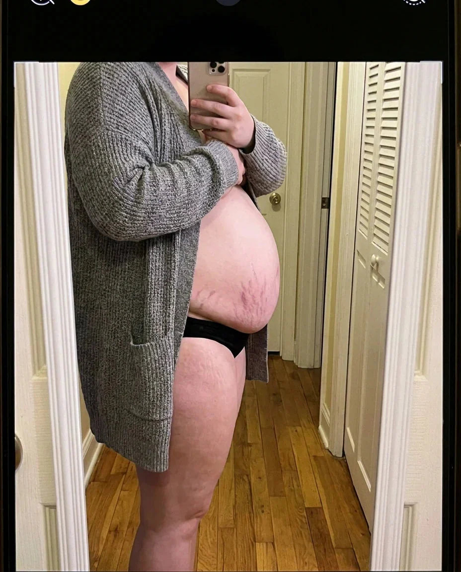 Side profile of postpartum belly, mirror photo at home