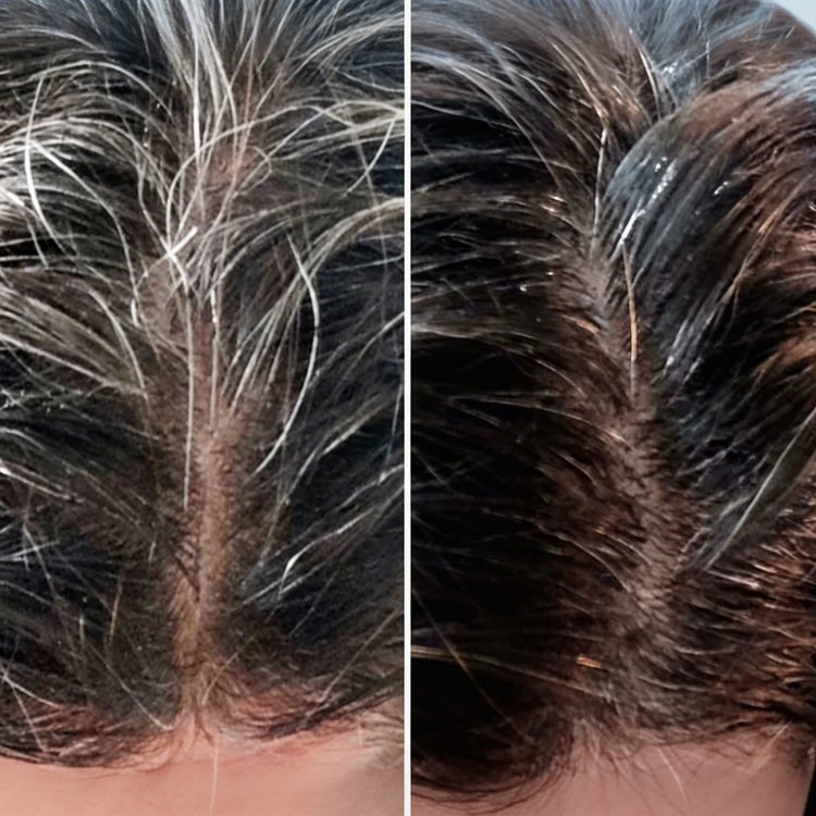 Before and After